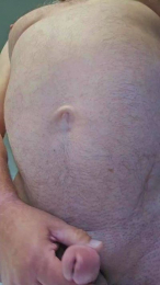 blister_1 webcam model stream image