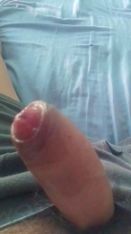 Dilatador webcam model stream image